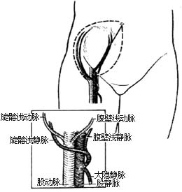下腹部皮瓣切取术