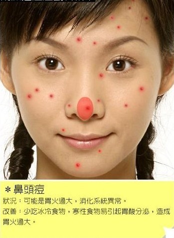 通过脸上痘痘位置看你的健康状况
