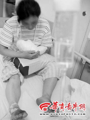 讨薪女赌气剁断自己手如今后悔