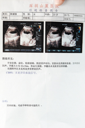 女工怀孕85天查出胎死30天 报料后被要求辞职