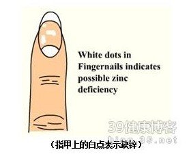 指甲出现十种状况要命！