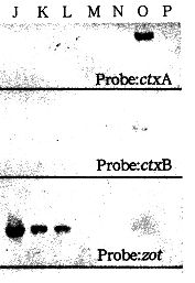 霍乱弧菌中存在不含霍乱毒素基因的噬菌体CTXΦ基因组