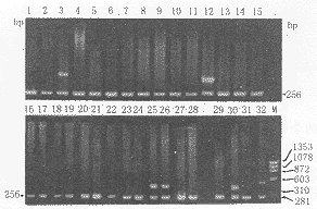 用ARMS/PCR-SSP方法对湖南籍汉族人HLA-A 座位多态性分析
