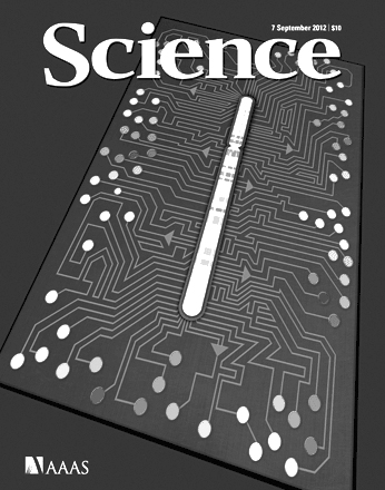科学快讯：一种罕见但可治疗的自闭症形式