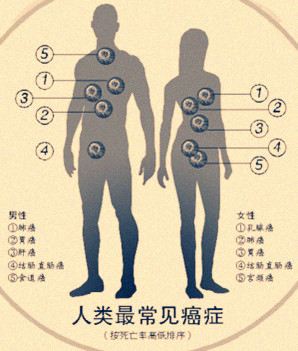 恶性肿瘤的热疗法--烫死癌细胞