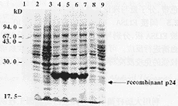 HIV-1核心蛋白p24在大肠杆菌中的表达与纯化①