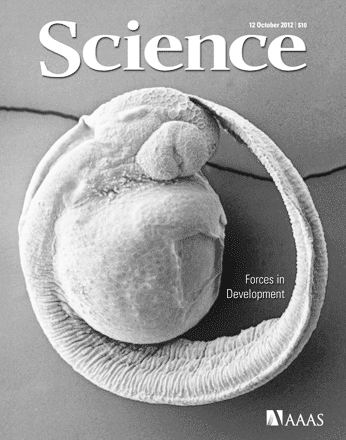 科学快讯：手机可帮助追踪肯尼亚的疟疾传播