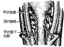 甲状旁腺切除术