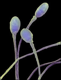 实拍人工受孕全过程