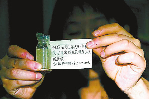 女子吞虫卵减肥致十几条蛔虫寄生腹中