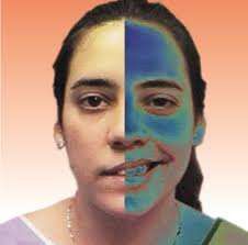 军医解答：面肌痉挛与面瘫是一回事吗