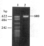 rBPI 23 基因克隆与鉴定