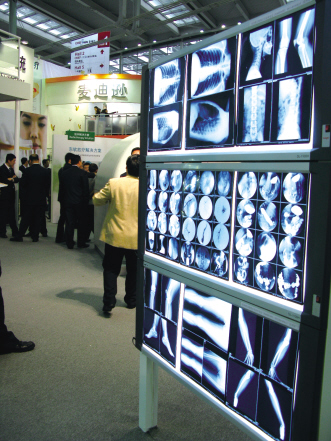 影像融合推动医学影像领域发展