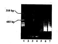 外源性IL-4基因表达对K562 细胞增殖及死亡的影响