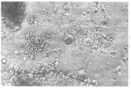 唾液中分离的人类疱疹病毒7型的电镜观察及分子生物学鉴定