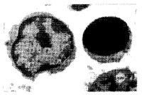抗U 1 RNP/Sm 抗体诱导人淋巴细胞凋亡的研究