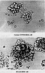 逆转录病毒介导重组CD23 cDNA 稳定整合的RVc23-8866细胞株的建立①