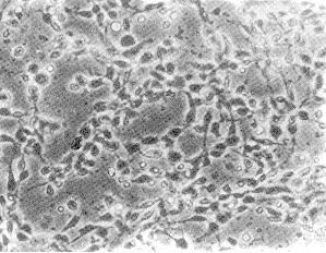 肾综合征出血热病人恢复期血清对汉滩病毒感染体外培养神经元的保护作用