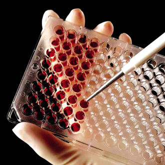 境内外资本加注诊断试剂