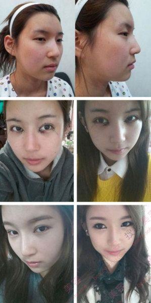 31个惊人韩国整容案例