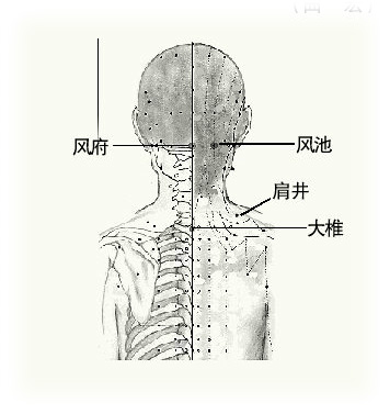 着凉头痛要祛风通络