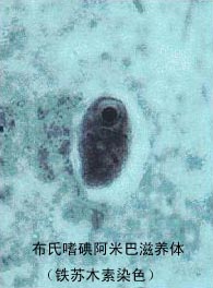 布氏嗜碘阿米巴滋养体（铁苏木素染色）