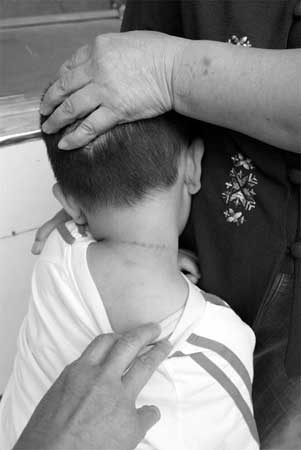3岁男童脖颈有一圈血印被疑在幼儿园受虐