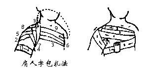 不同部位的绷带包扎步骤