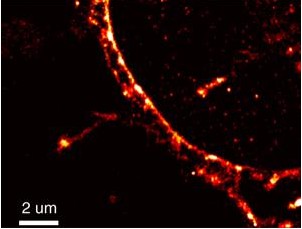PNAS：超分辨率图像分析揭示HIV感染策略