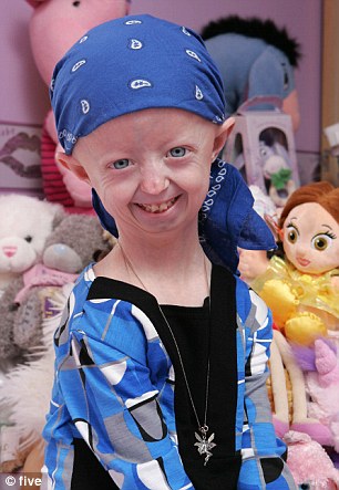 14岁早衰少女拥有105岁人的躯体