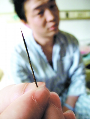 缝衣针扎进男子心脏从大腿拔出 医生惊呼命真大