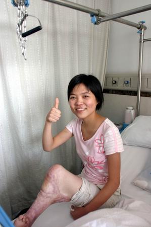 女大学生为保学业选择截肢