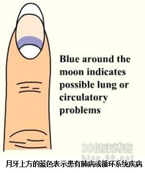 指甲出现十种状况要命！