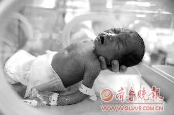 女子自然受孕31周后产下四胞胎