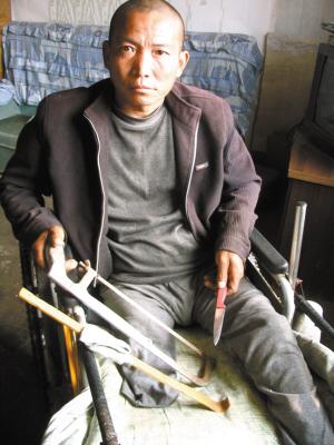 男子因无钱做手术 家中自己锯掉患怪病右腿