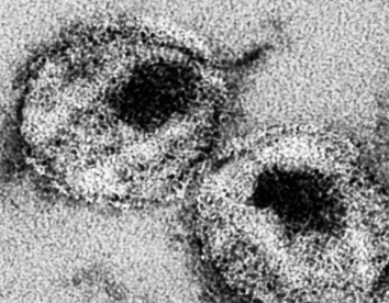 美CDC呼吁为国民提供更多HIV检测