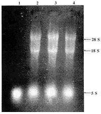 人白细胞分化抗原CD59基因克隆及序列分析
