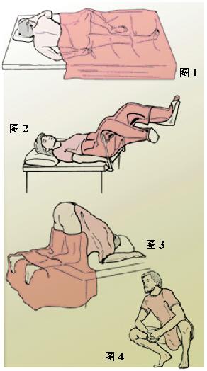 肛肠检查经验之谈