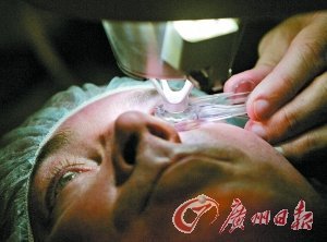 激光矫正近视安全性存疑