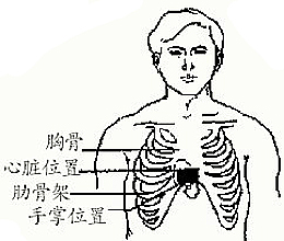 遇见猝死怎么救