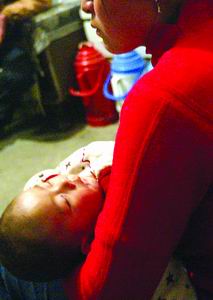 半岁女婴患先天疾病遭弃 慈善机构启动救助程序