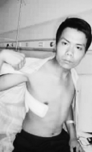 开胸验肺农民工忆辛酸维权：愿帮更多患病工友
