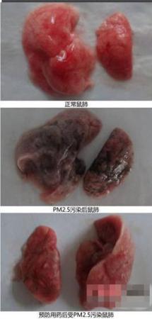 复旦专家：雾霾6天使鲜肺变黑且不可逆转报道不实