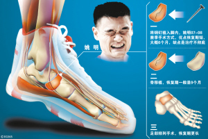 舟骨受伤要早治