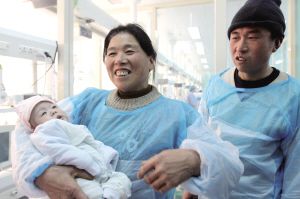 连体女婴手术后1个存活1个死亡