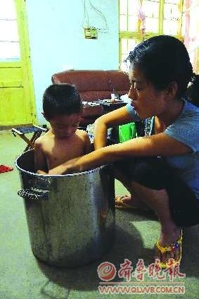 4岁男孩4成皮肤无汗毛孔奇痒无比