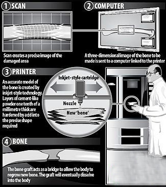 科学奇迹 十大不思议的人造器官