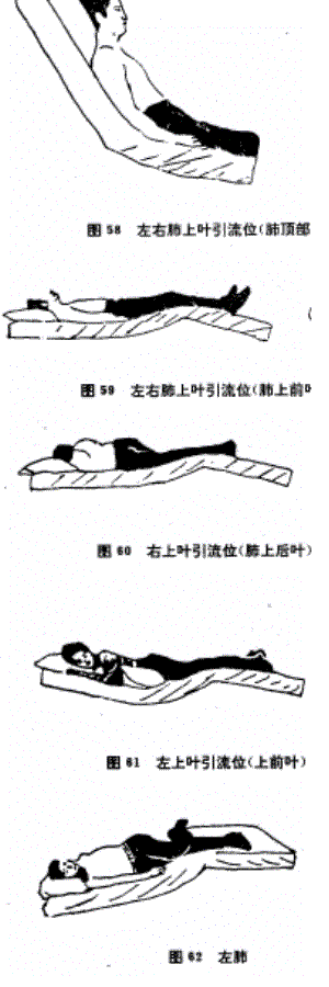 体位引流及其辅助治疗