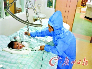 3岁男童掉进热水烫脱半身皮肤 需做多次手术