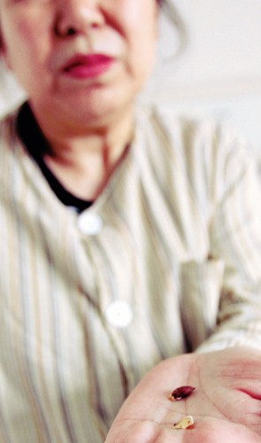 病人医院吃发糕被硌掉半颗牙 欲走法律途径索赔